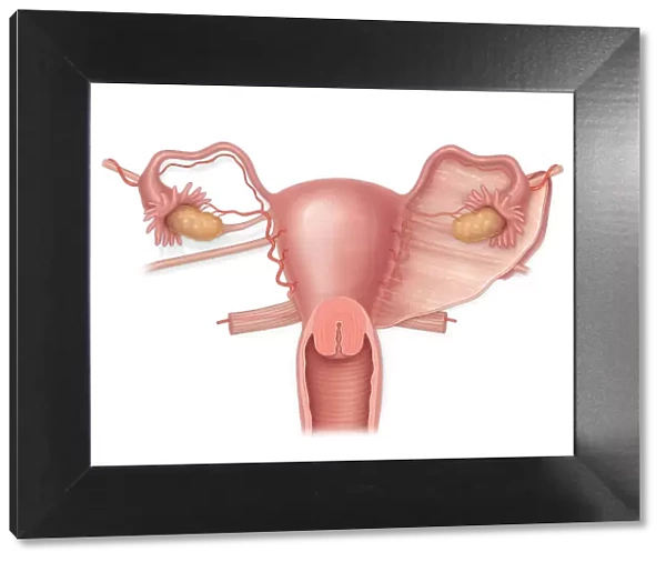 Anterior view of a normal uterus with ovaries, fallopian tubes, and broad ligament