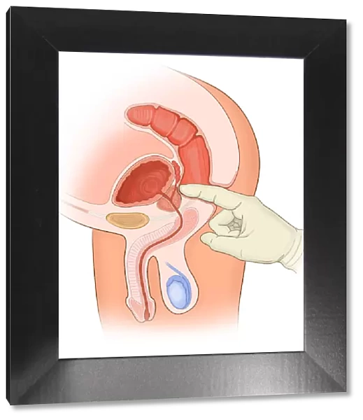 Rectal exam of a normal male in cross section anatomy