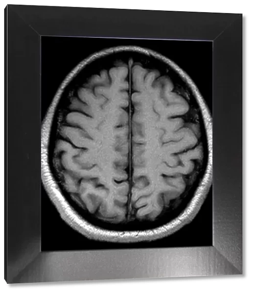 Brain MRI, right and left side of brain, top view of brain, male, brain artwork, 150093213