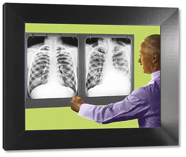 Man Looking at Two Chest X-Rays