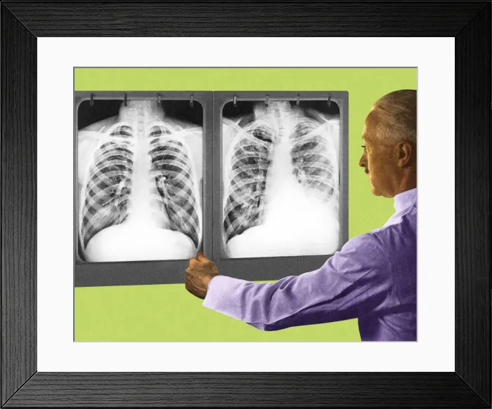 Framed Print : Man Looking at Two Chest X-Rays Framed Print : Man Looking at Two Chest X-Rays