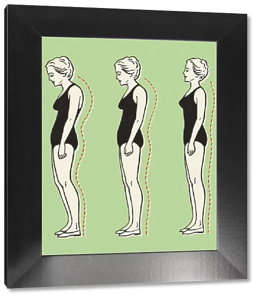 Woman Standing With Better Posture
