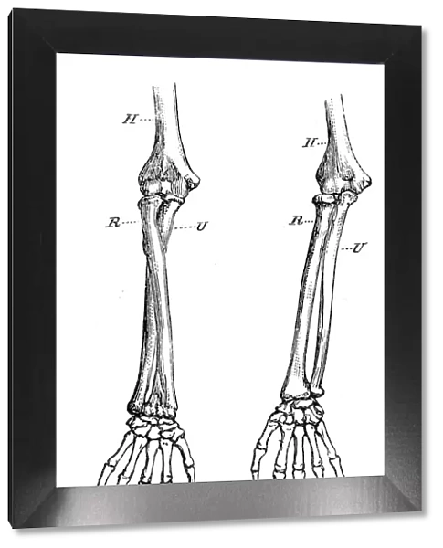 Bones of the right forearm engraving anatomy 1872