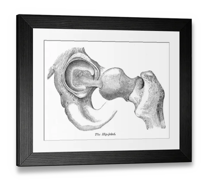 Framed Print : Hip joint engraving anatomy 1872 Framed Print : Hip joint engraving anatomy 1872