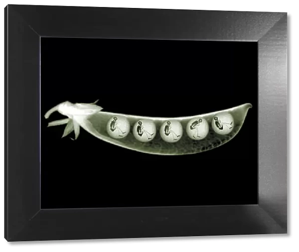 Peas in a pod with skeletons, X-ray