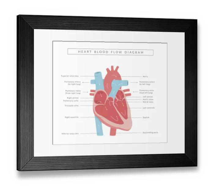 Framed Print : square board Framed Print : square board