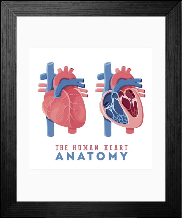 Framed Print : Inima Plat 2 Framed Print : Inima Plat 2