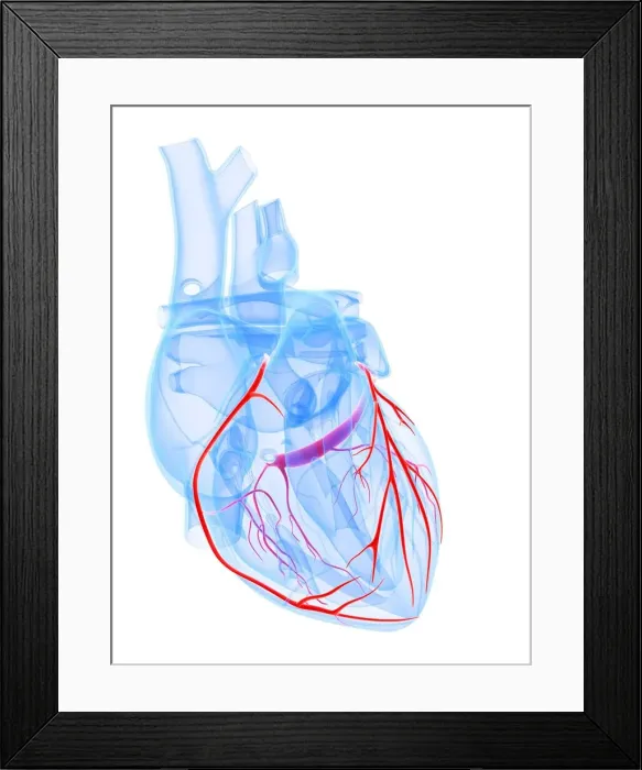 Framed Print : Healthy heart, artwork Framed Print : Healthy heart, artwork