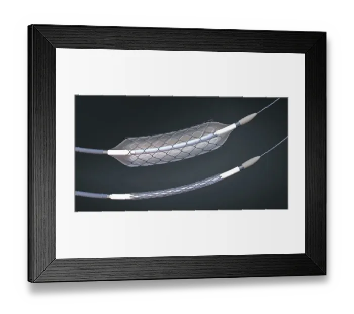 Framed Print : Stents and balloon catheters, illustration Framed Print : Stents and balloon catheters, illustration