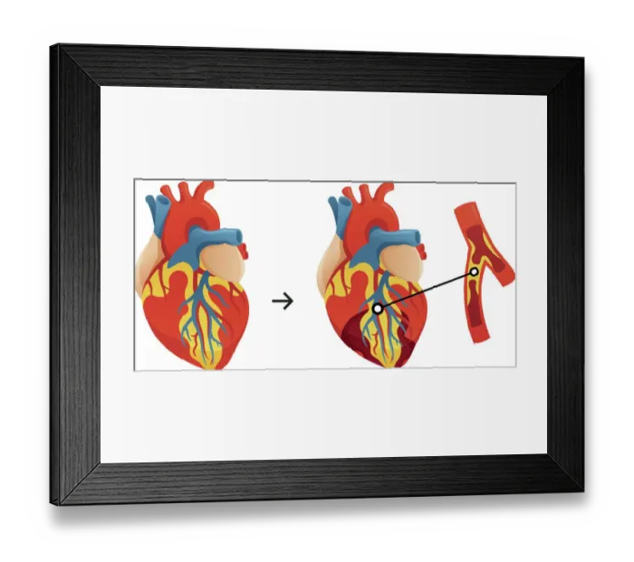 Framed Print : The Human Heart, 487275063 Framed Print : The Human Heart, 487275063
