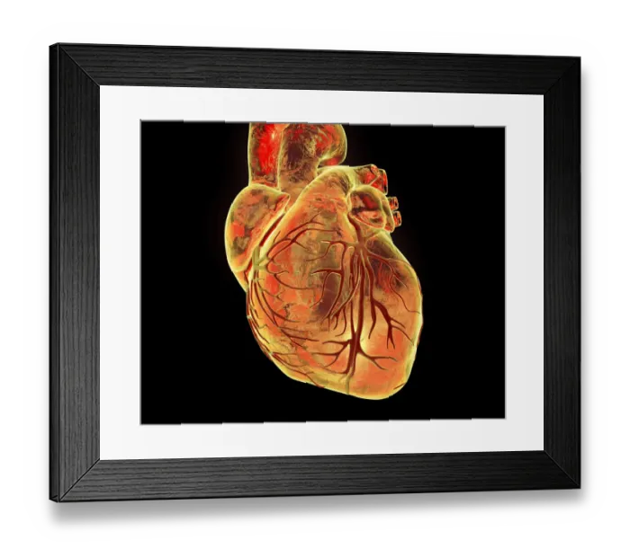 Framed Print : Heart with coronary vessels, illustration Framed Print : Heart with coronary vessels, illustration