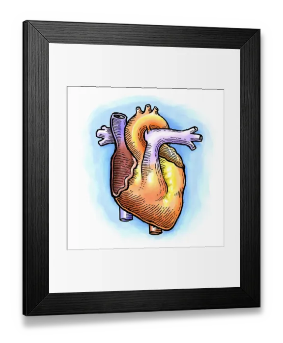 Framed Print : Human Heart Framed Print : Human Heart