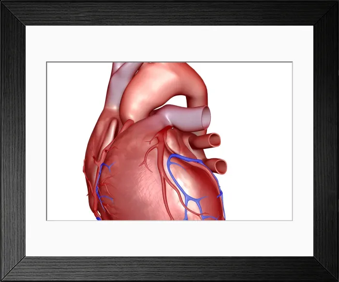 Framed Print : The coronary vessels of the heart Framed Print : The coronary vessels of the heart