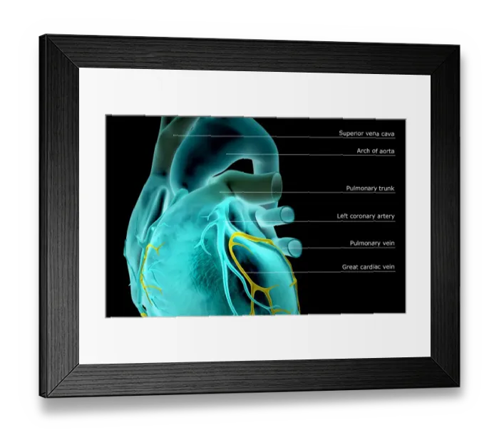 Framed Print : The coronary vessels of the heart Framed Print : The coronary vessels of the heart