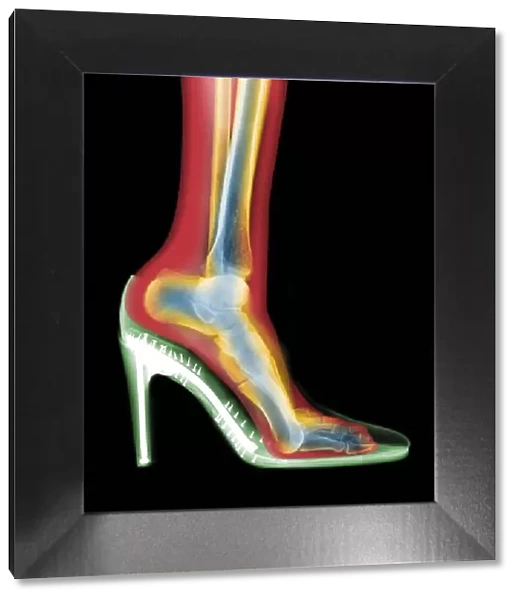 Leg in stiletto shoe MRI style, X-ray