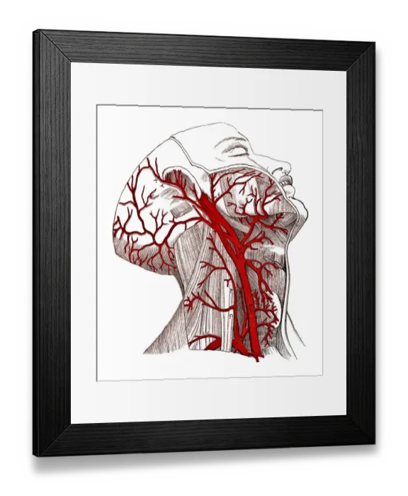 Framed Print : Arteries of The Head Framed Print : Arteries of The Head