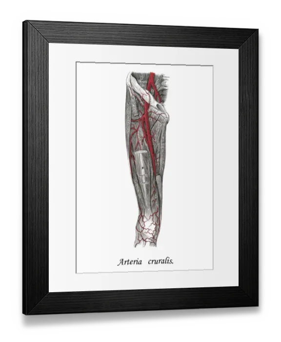 Framed Print : Old chromolithograph illustration of human circulatory system - Crural arteries Framed Print : Old chromolithograph illustration of human circulatory system - Crural arteries