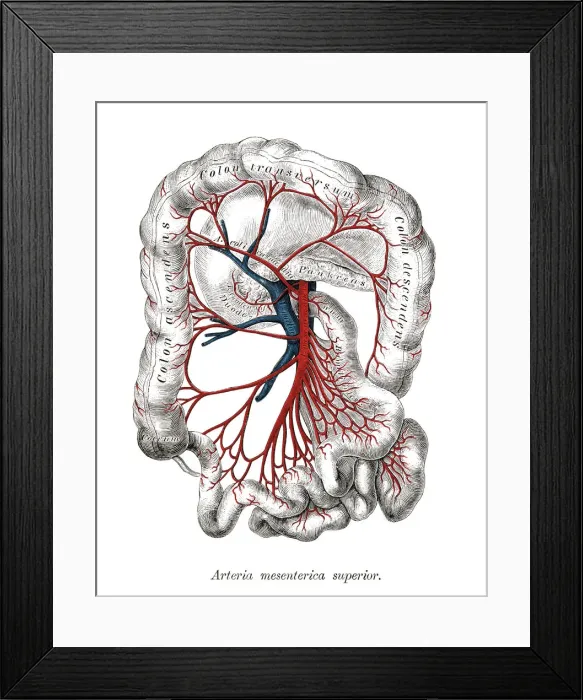 Framed Print : Old chromolithograph illustration of human circulatory system - Arteria mesenterica inferior Framed Print : Old chromolithograph illustration of human circulatory system - Arteria mesenterica inferior