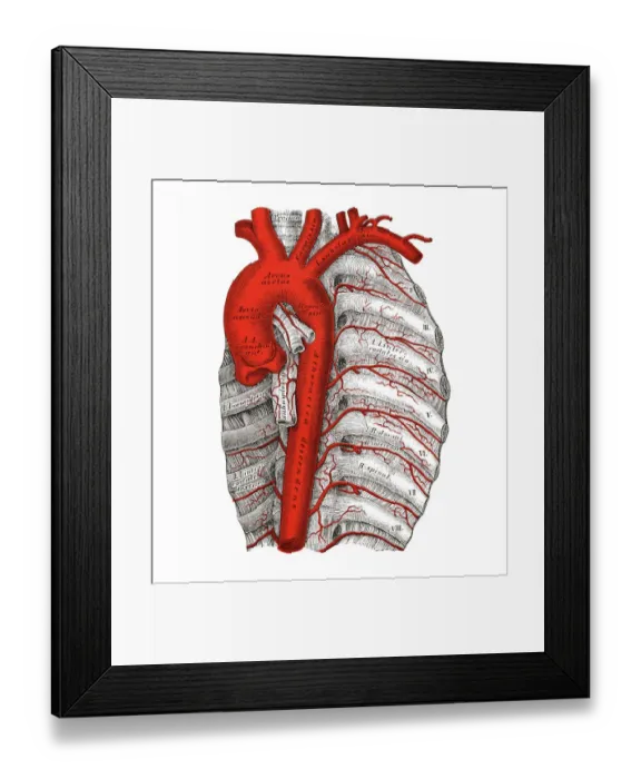 Framed Print : Old chromolithograph illustration of human circulatory system - aorta thoracica