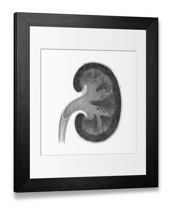 Framed Print : Old chromolithograph illustration of section of human kidney