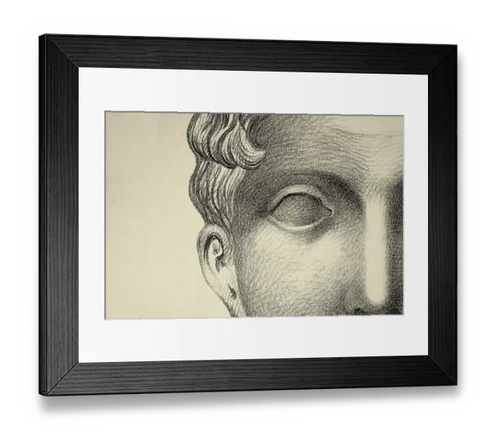 Framed Print : Vintage illustration Close up detail of the human face, blank eye, vision, blindness, 19th Century Framed Print : Vintage illustration Close up detail of the human face, blank eye, vision, blindness, 19th Century