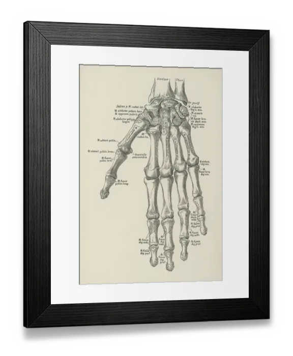 Framed Print : Old engraved illustration of the bones of the left hand Framed Print : Old engraved illustration of the bones of the left hand