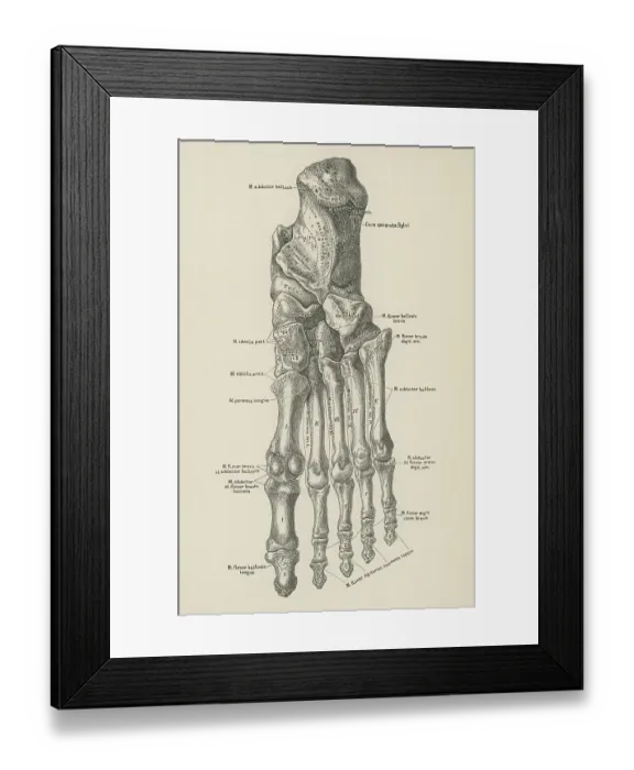Framed Print : Old engraved illustration of the bones of the foot Framed Print : Old engraved illustration of the bones of the foot
