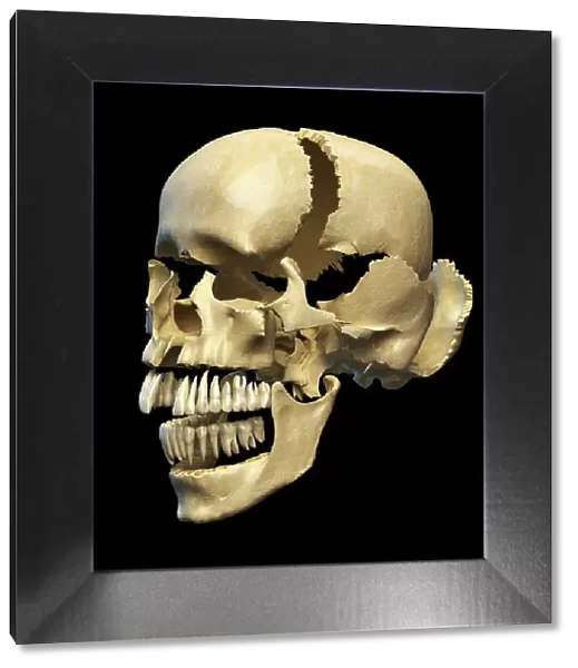 Human skull in sections, artwork