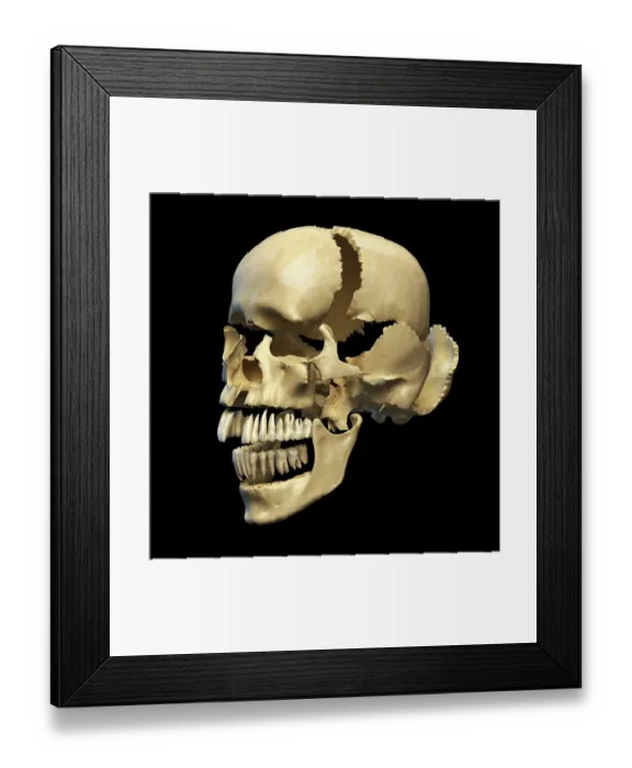 Framed Print : Human skull in sections, artwork
