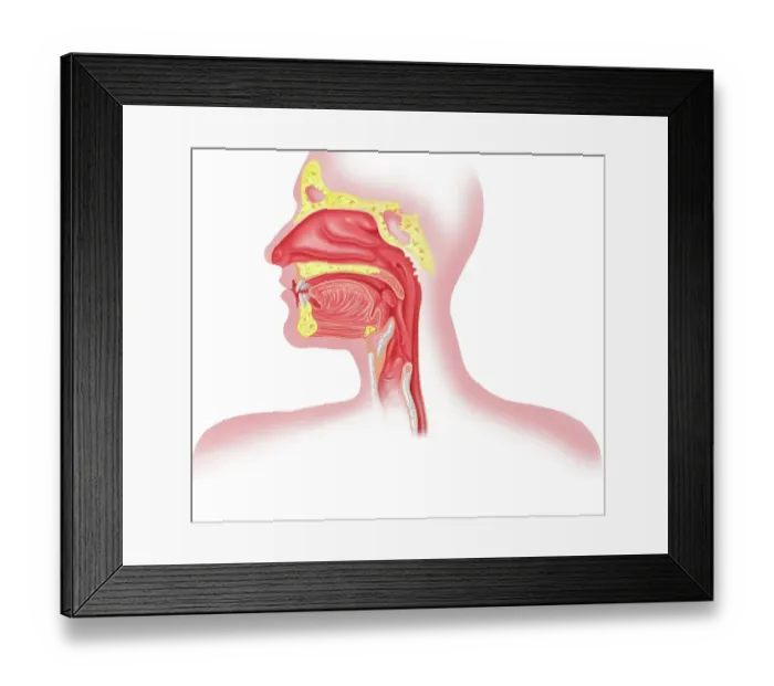 Framed Print : Upper respiratory tract, artwork Framed Print : Upper respiratory tract, artwork