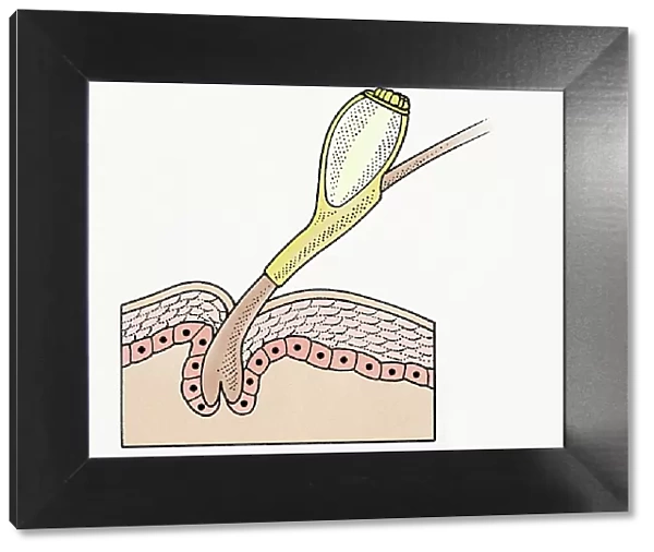 Cross section illustration of Head Louse (Pediculus humanus capitis) egg on human hair
