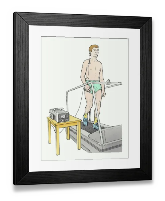 Framed Print : A man on a running machine with oximeter attached to his ear Framed Print : A man on a running machine with oximeter attached to his ear