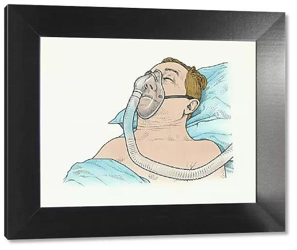 A sleep apnea patient with mask