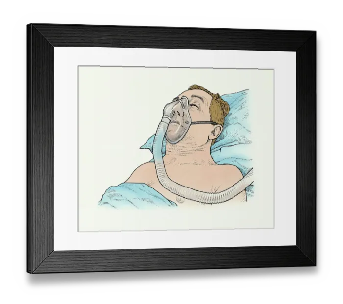 Framed Print : A sleep apnea patient with mask Framed Print : A sleep apnea patient with mask