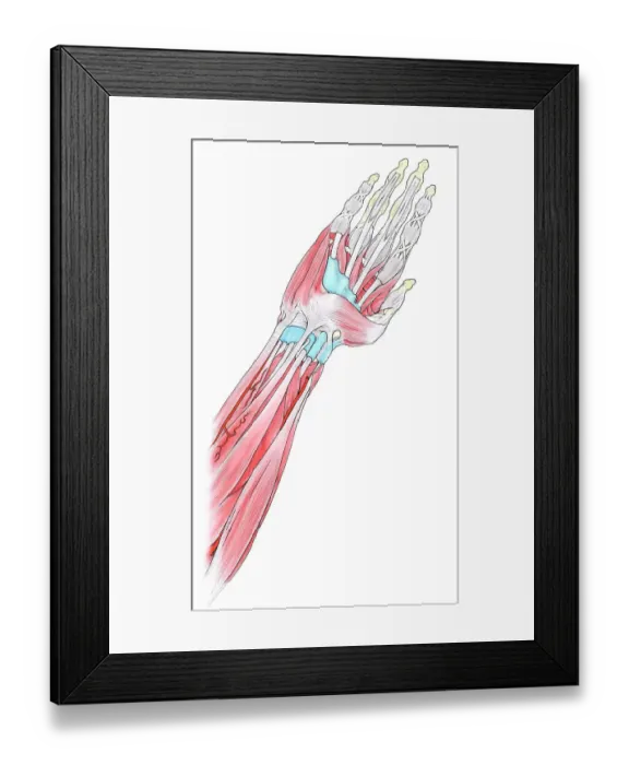 Framed Print : Muscles in human hand and arm Framed Print : Muscles in human hand and arm