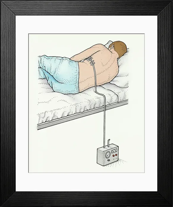 Framed Print : A man on a bed with a chest drain in his side recovering from pneumothorax (collapsed lung) Framed Print : A man on a bed with a chest drain in his side recovering from pneumothorax (collapsed lung)