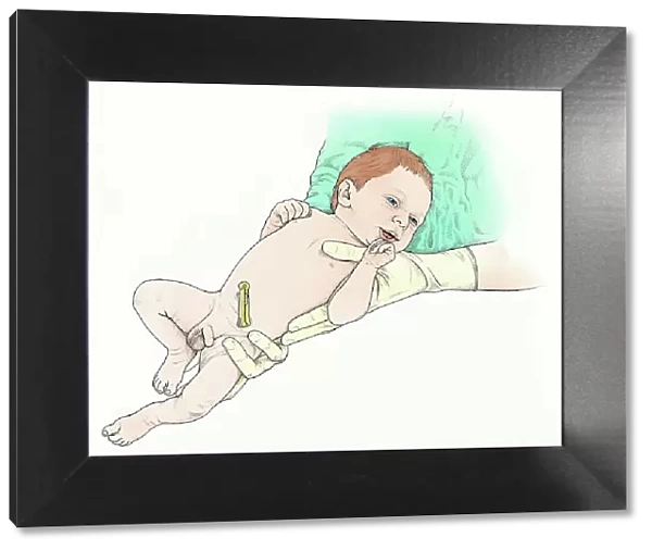 Illustration of midwife holding baby boy, with clamp on umbilical cord