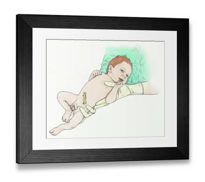 Framed Print : Illustration of midwife holding baby boy, with clamp on umbilical cord Framed Print : Illustration of midwife holding baby boy, with clamp on umbilical cord