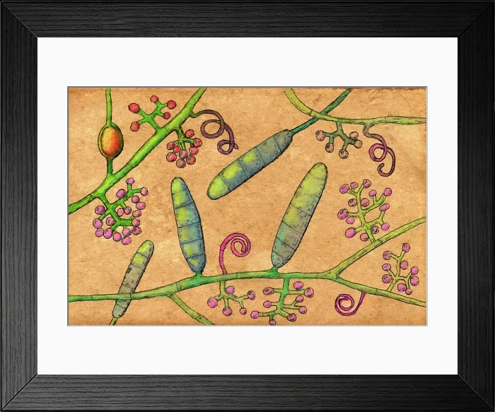 Framed Print : Trichophyton mentagrophytes fungi, illustration Framed Print : Trichophyton mentagrophytes fungi, illustration