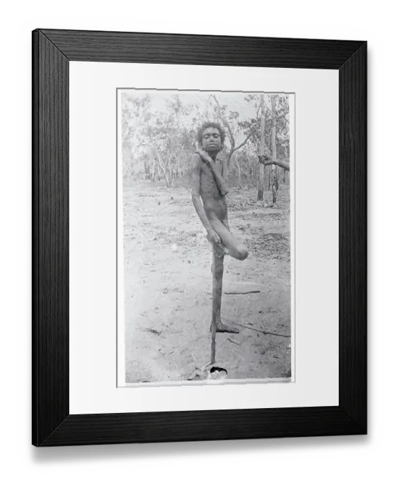 Framed Print : Young Australian Native Posing on One Leg Framed Print : Young Australian Native Posing on One Leg