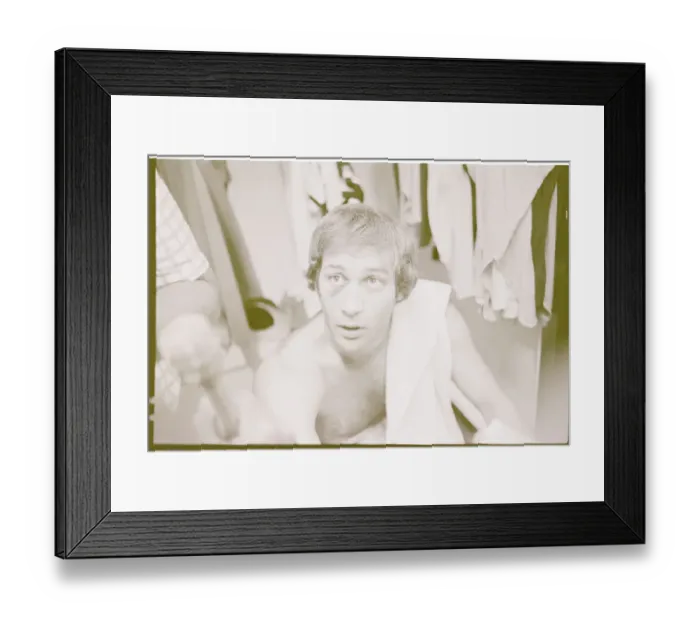 Framed Print : Baseball Player John Montefusco with Black Eye