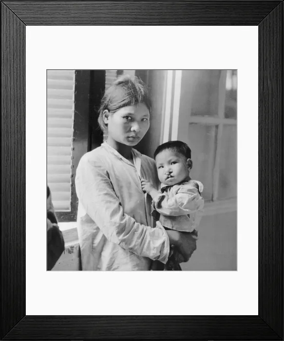 Framed Print : Vietnamese Woman Holds Deformed Baby Framed Print : Vietnamese Woman Holds Deformed Baby