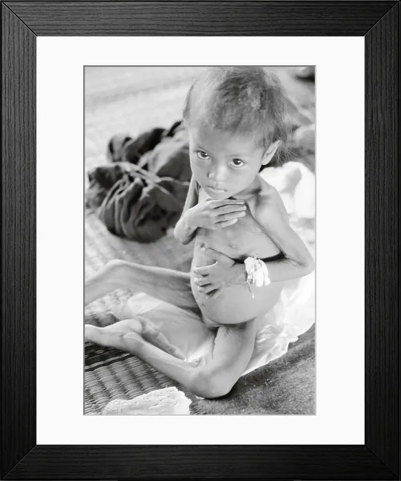 Framed Print : Portrait of an Emaciated Cambodian Child Framed Print : Portrait of an Emaciated Cambodian Child