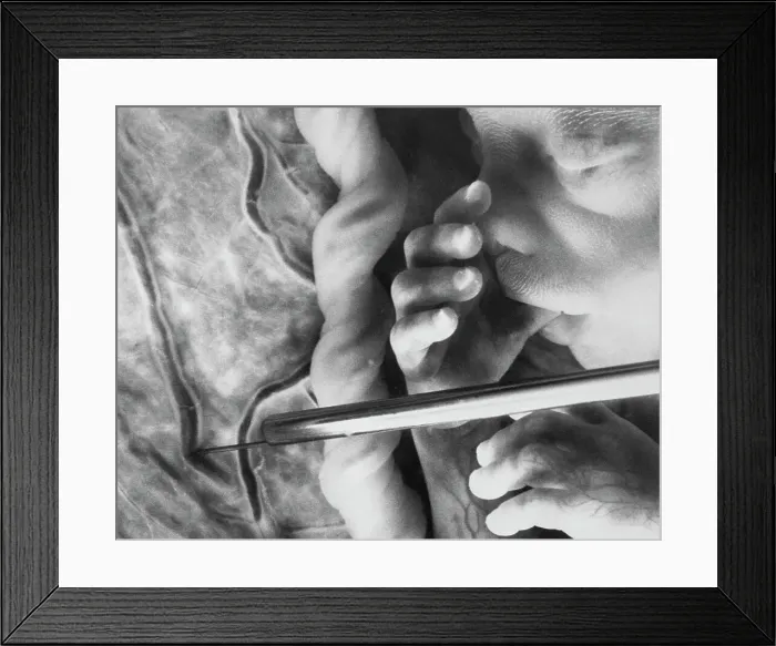 Framed Print : Medical Telescope Inside Pregnant Woman's Womb Framed Print : Medical Telescope Inside Pregnant Woman's Womb