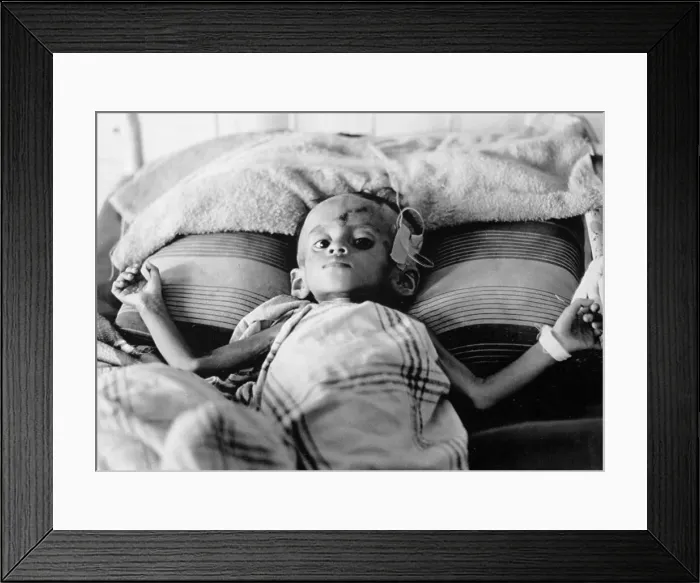 Framed Print : Malnourished Cambodian Child Framed Print : Malnourished Cambodian Child