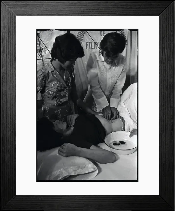 Framed Print : Alex Orbito is Shown Treating a Patient's Stomach Framed Print : Alex Orbito is Shown Treating a Patient's Stomach