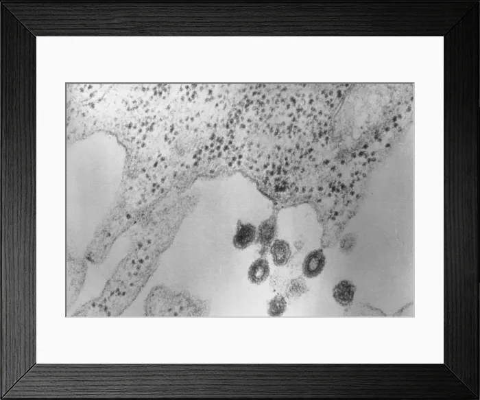 Framed Print : Tumors Budding from Cell Membrane Framed Print : Tumors Budding from Cell Membrane