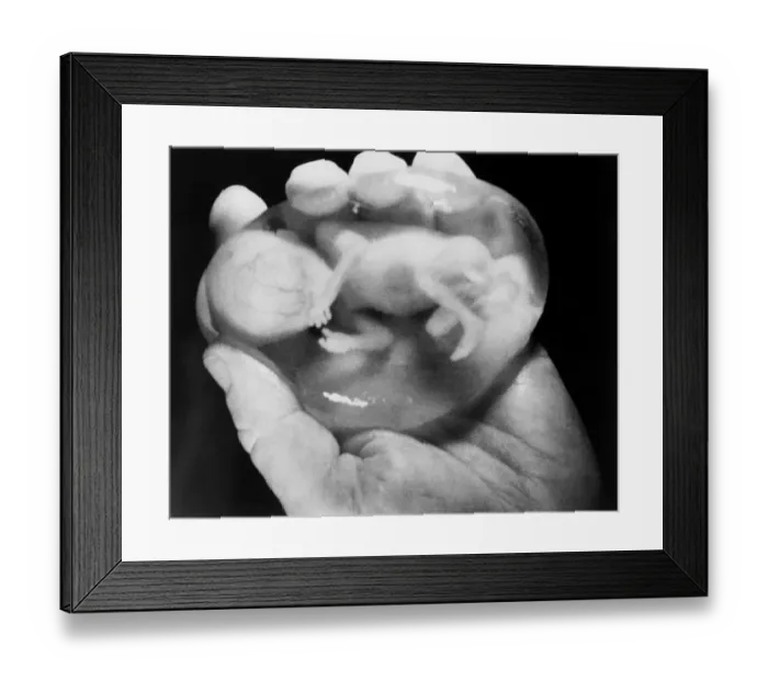 Framed Print : Doctor Holding Aborted Fetus Framed Print : Doctor Holding Aborted Fetus