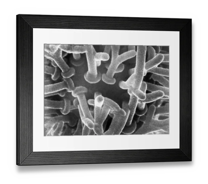 Framed Print : Synaptic Knobs First Photographed Framed Print : Synaptic Knobs First Photographed