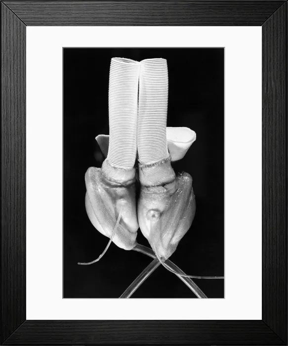 Framed Print : Early Artificial Heart Framed Print : Early Artificial Heart